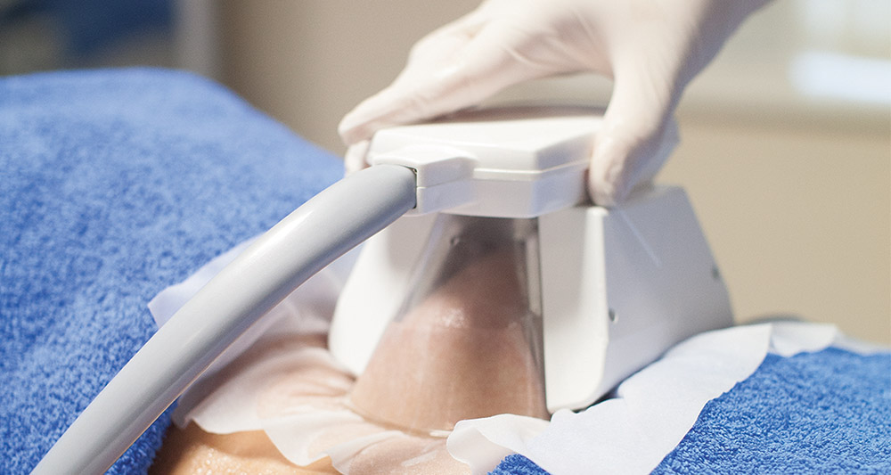 How Fat Freezing and HIFU Work Together? 2 Multiple Areas in One Session HIFU and Fat Freezing Tetbury