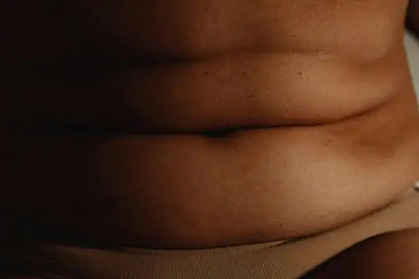 The Hidden Connection: How Stress Shapes Your Fitness and Body Composition 3 image of what stress can do on the stomach area and how Lipo 360 Tetbury can help to change your body shape.