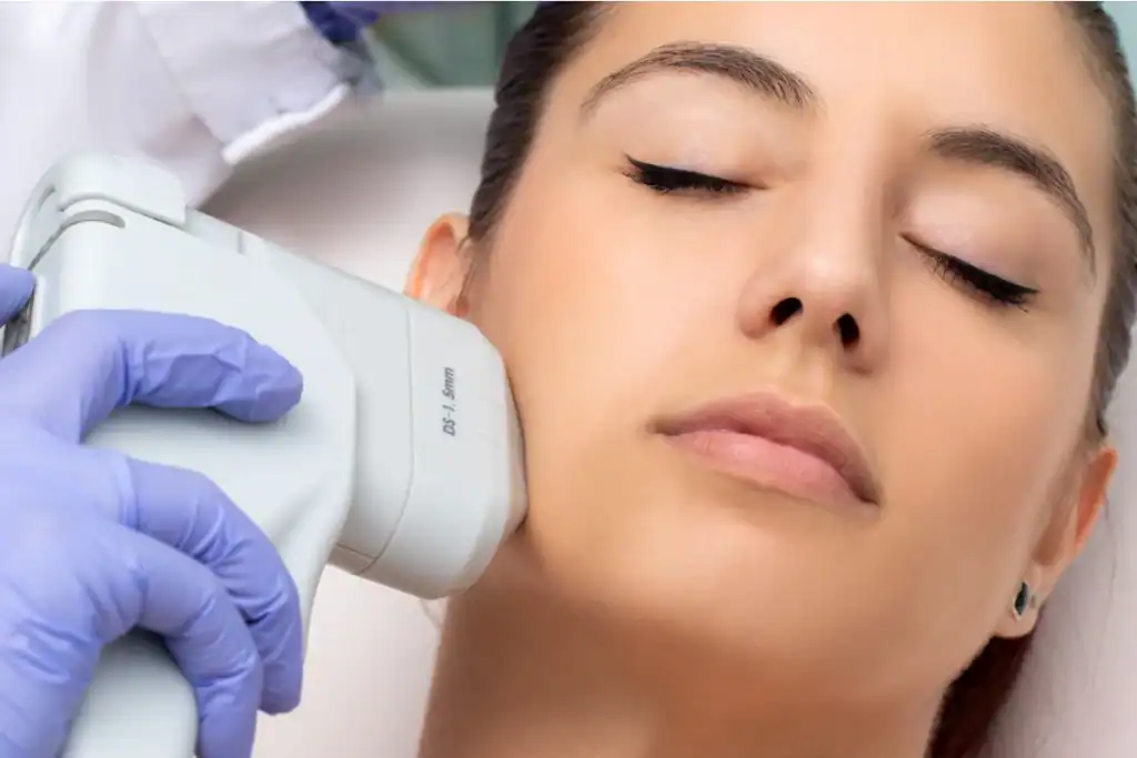 Discover the Perfect Duo: RF Microneedling and HIFU 2 Image of Morpheus8 And HIFU Combined with Lipo 360 Tetbury